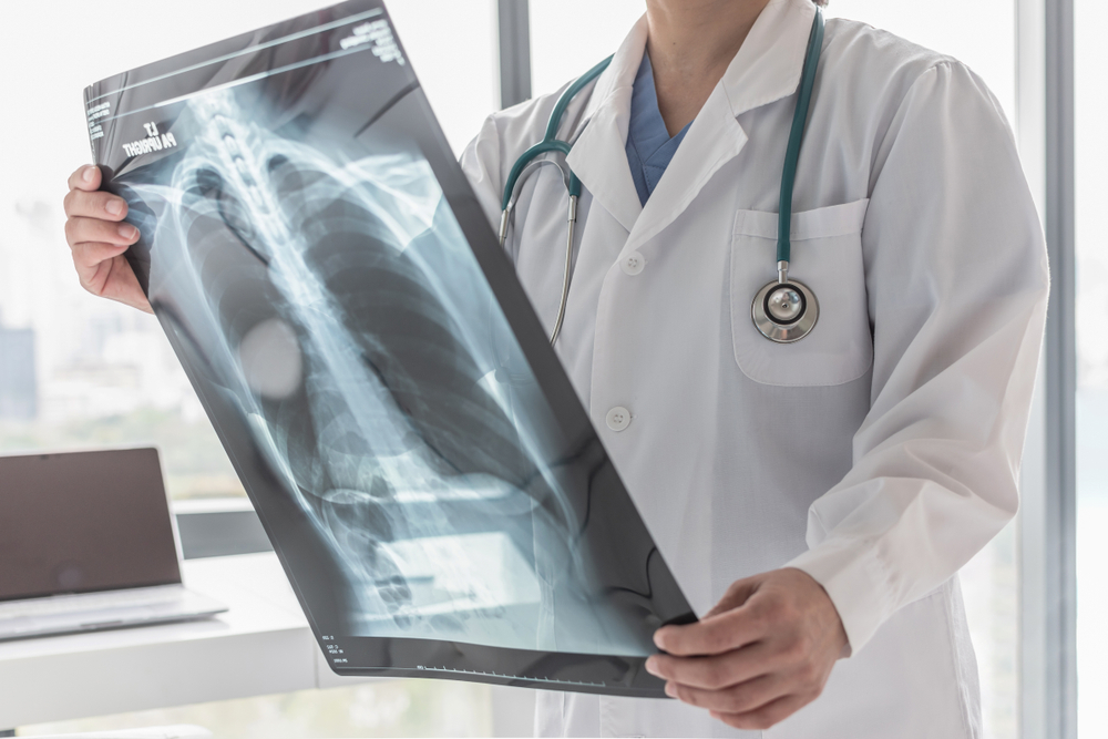 Understanding Cystic Fibrosis