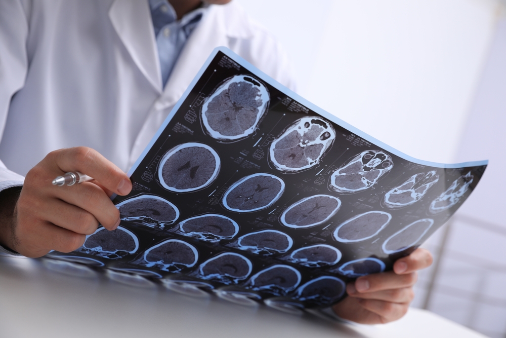 multiple sclerosis swetech medical center multiple sclerosis swetech medical center