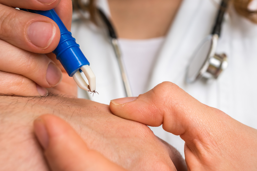 treatment lyme disease swetech medical center treatment lyme disease swetech medical center