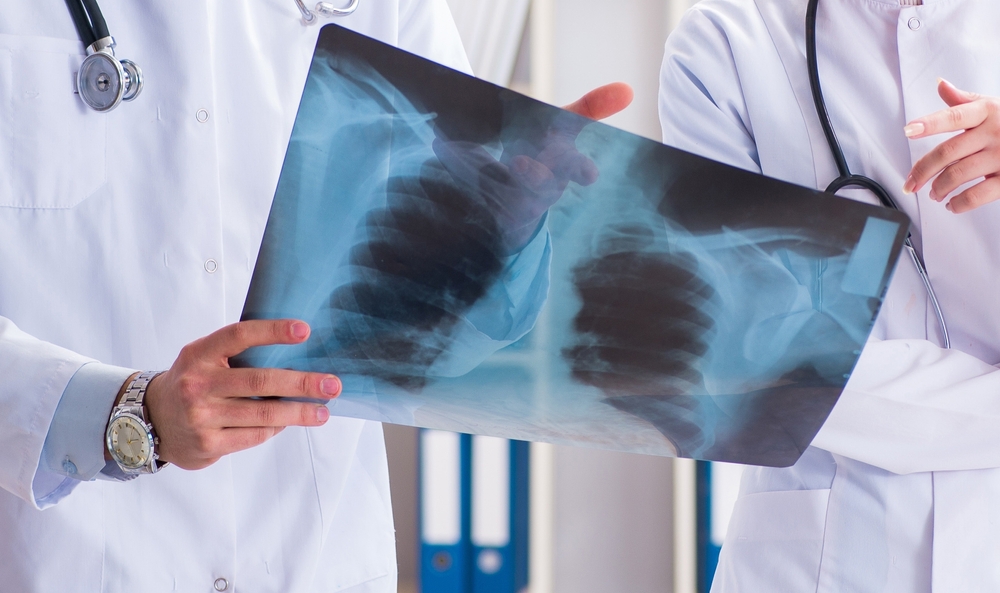 Influenza and pneumonia